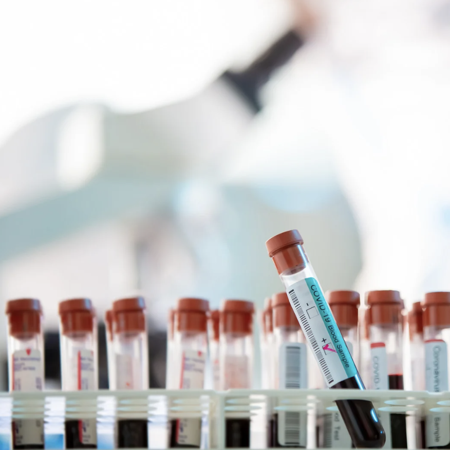 On-Site Lab Services